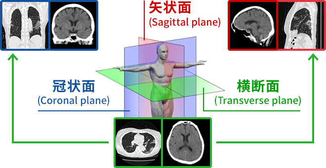 図：人体を管状面、横断面、矢状面から撮るイメージ図